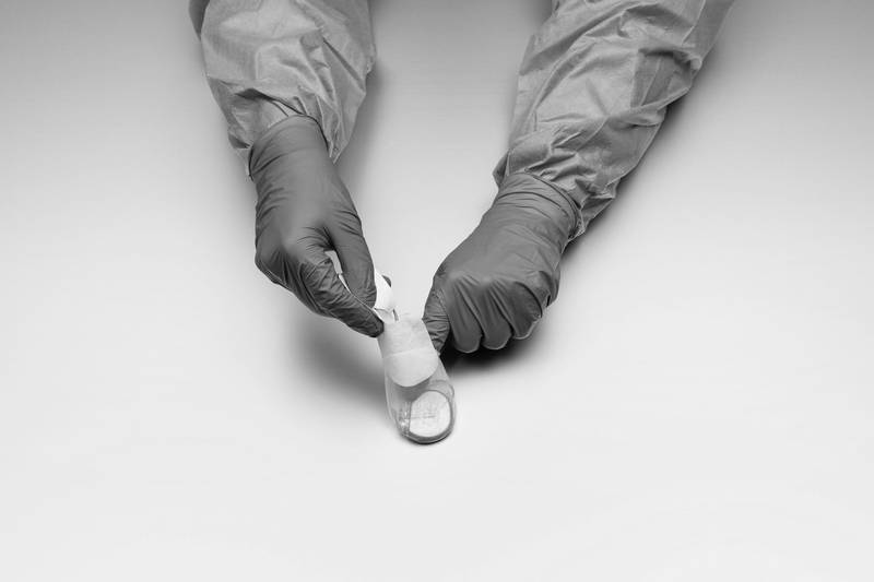 Foldable surgical applicator 3FOLD (Source: Laurin Schaffner and Benjamin Josi with Hansruedi Rohrer)