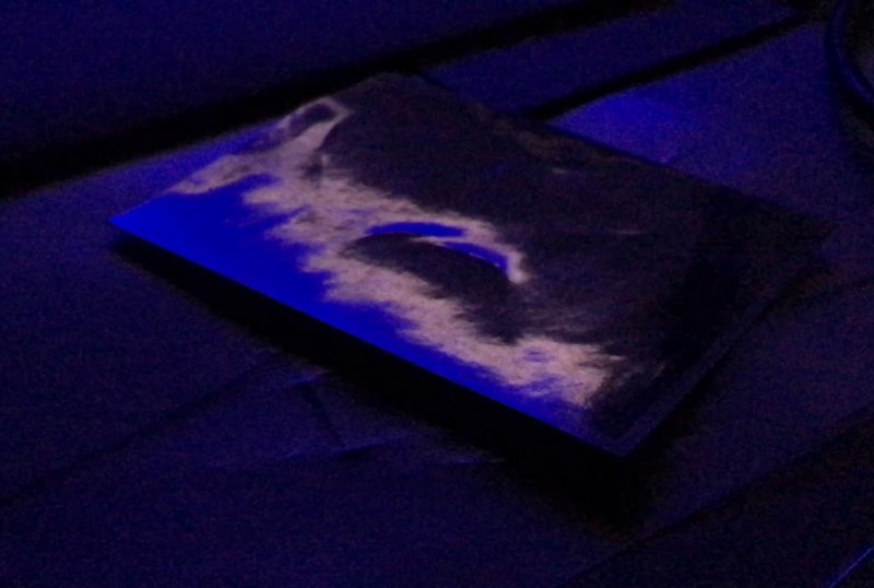 5 different Noises. One Picture. Notes on a Method (2020/21), SNF Forschungsprojekt: « „“ Insert Citation», Noëmie Stähli