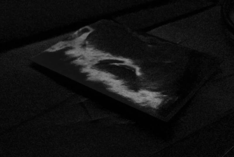 5 different Noises. One Picture. Notes on a Method (2020/21), SNF Forschungsprojekt: « „“ Insert Citation», Noëmie Stähli